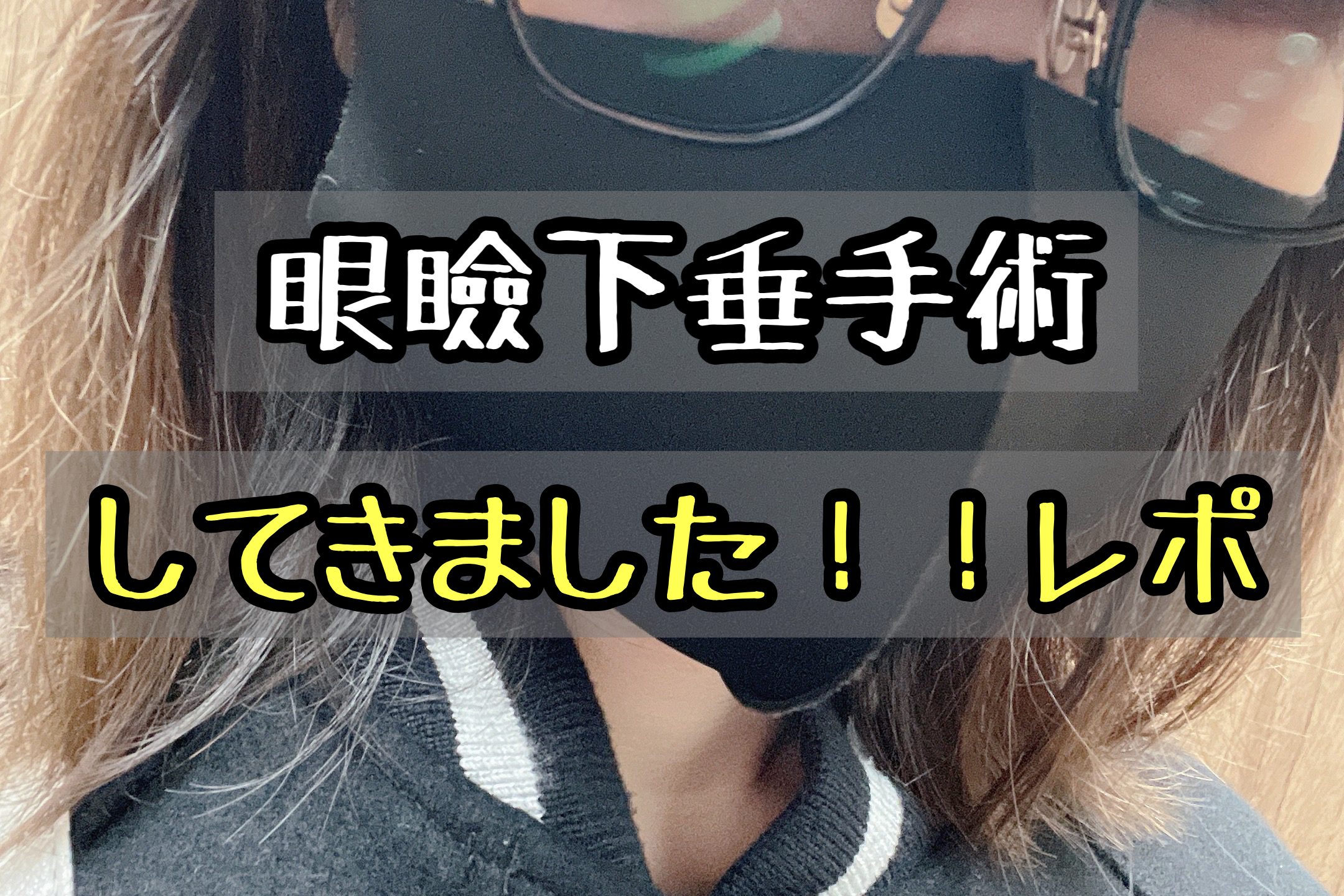 眼瞼下垂とは 軽度でも手術で二重になれる 実際にやってきたブログ メメコメモ