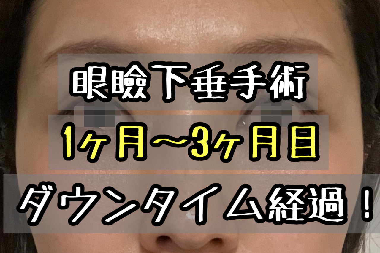 眼瞼下垂手術のダウンタイム経過ブログ 3ヶ月経過して跡はどうなった 画像付きでレポします メメコメモ